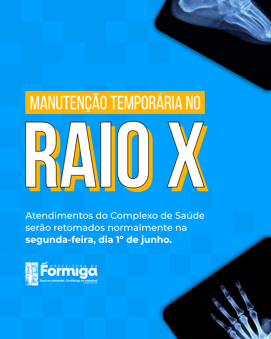 RAIO_X.png